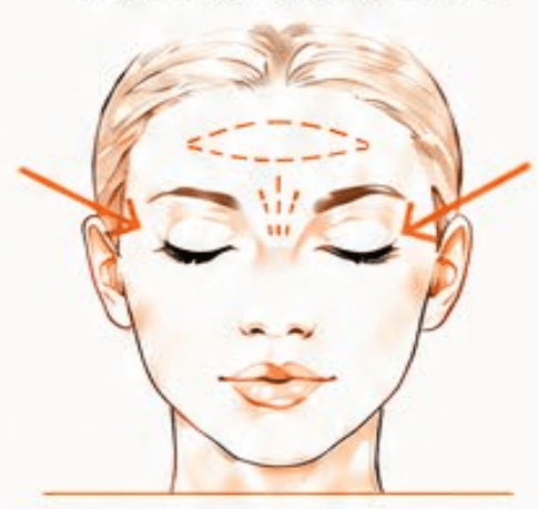 Full Upper Face treatment area diagram